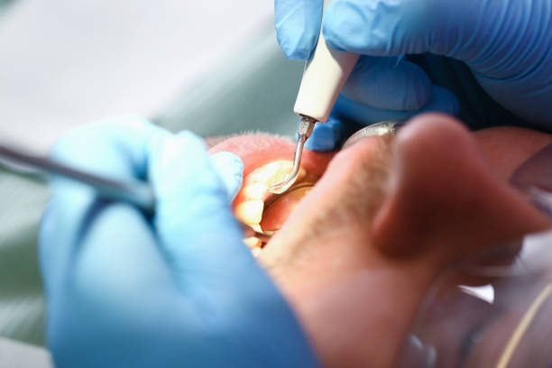 Best Holiday Emergency Dentist in Marshville, NC