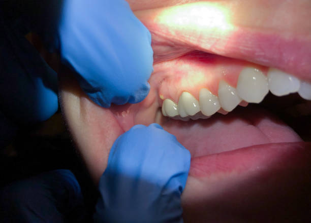 Best Emergency Dental Services for Seniors in Marshville, NC