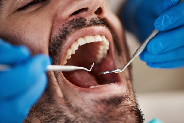 Best Mobile Emergency Dentist in Marshville, NC