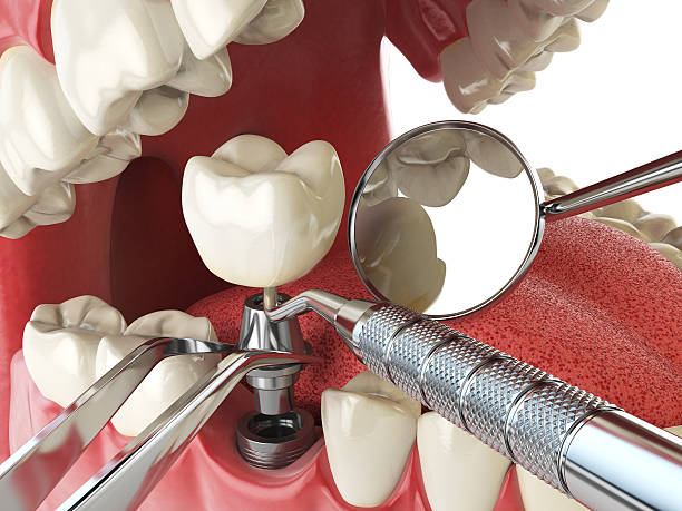 Best Emergency Cosmetic Dentistry in Marshville, NC